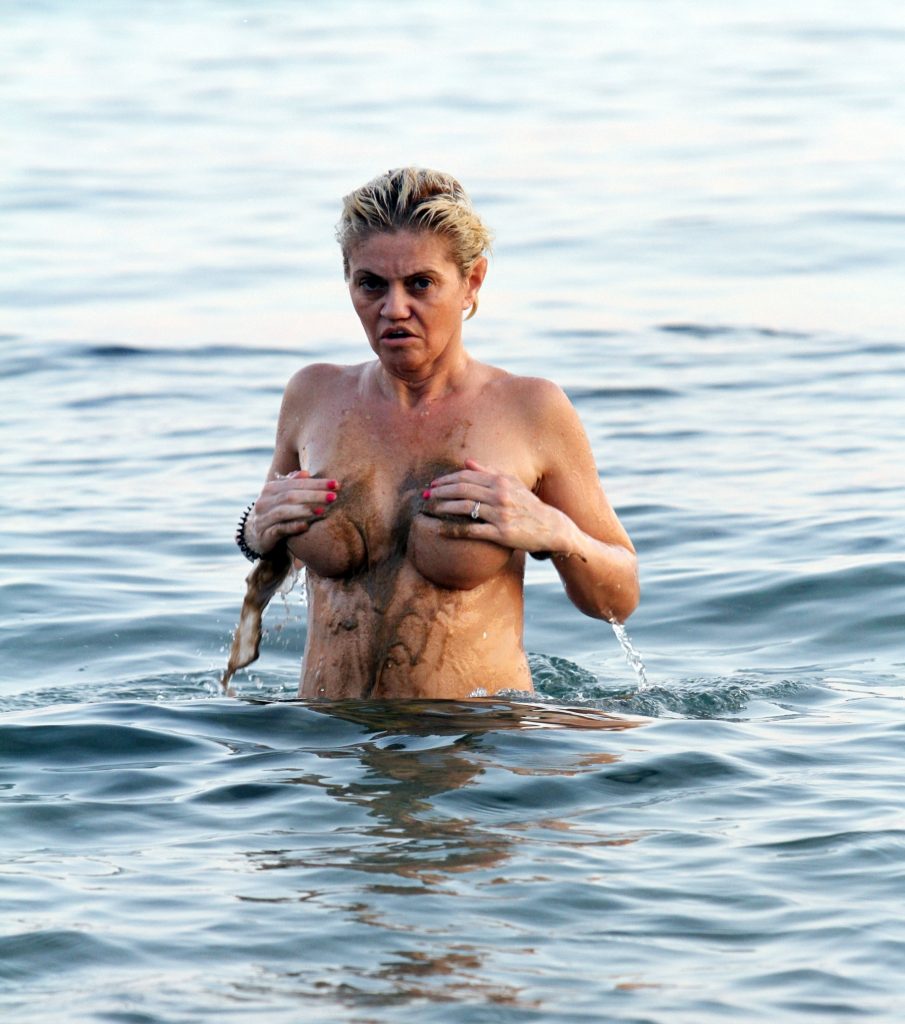 Disturbing to many, sexy to some: Danniella Westbrook shows her tits galler...