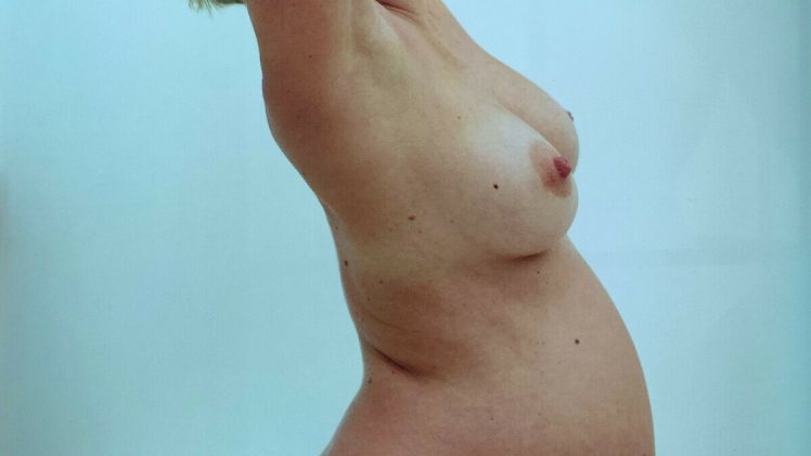 Very Pregnant Chloë Sevigny Strips Fully Naked for a Daring Photoshoot